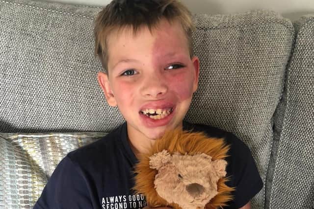 Isaac faces a major brain operation at Great Ormond Street Hospital