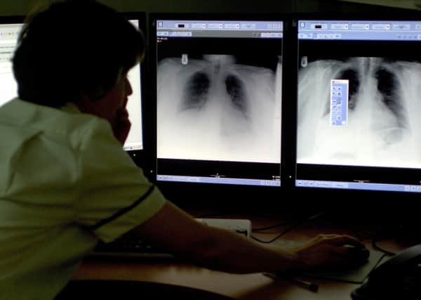 TB rates are high in Peterborough compared to the national average. Photo: PA EMN-200810-125708001