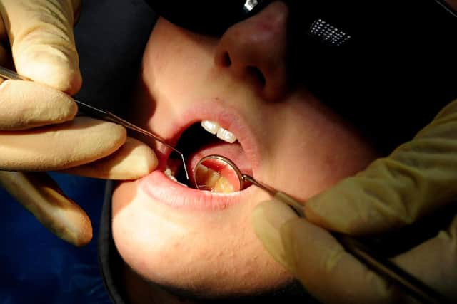 Peterborough children get tens of thousands fewer dental treatments. Photo: PA EMN-211202-103157001