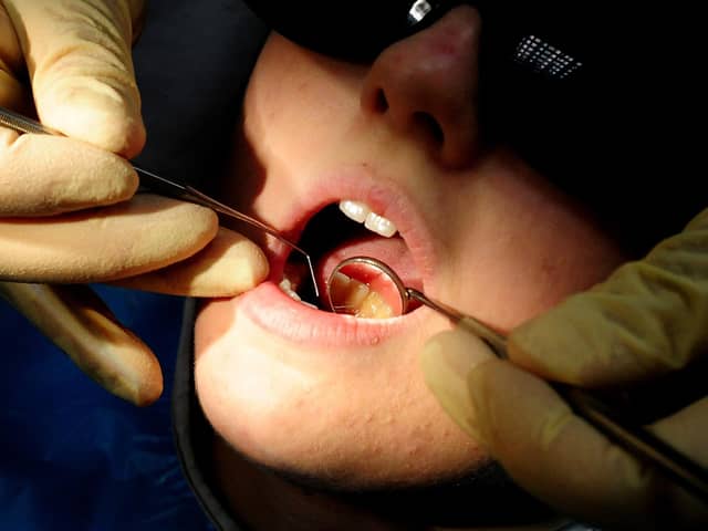 Almost seven in 10 Peterborough dental patients not seen in two years. Photo: PA EMN-210503-173329001