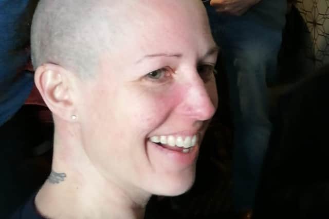 Vicky King after her hair was shaved off