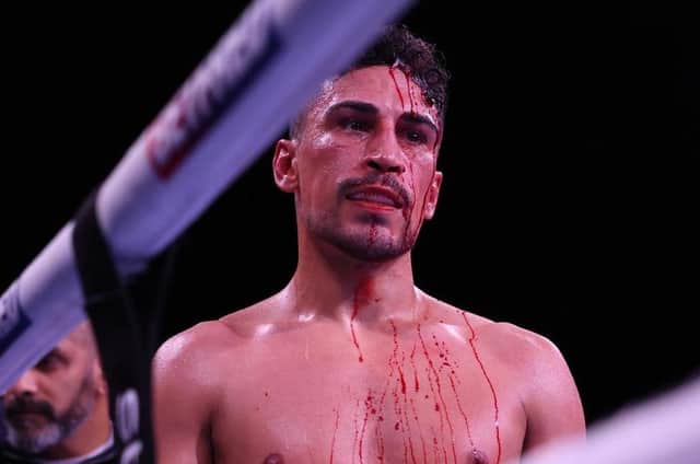 Jordan Gill after his fight with Alan Castillo was stopped. Photo: Matchroom Boxing.