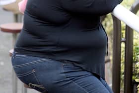 More people were admitted to hospital due to obesity in Peterborough - two thirds of them women. Photo: PA EMN-210520-161049001