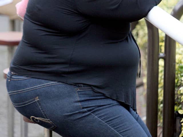 More people were admitted to hospital due to obesity in Peterborough - two thirds of them women. Photo: PA EMN-210520-161049001