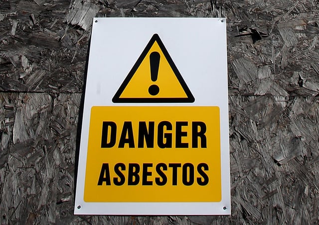 can asbestosis cause pulmonary fibrosis