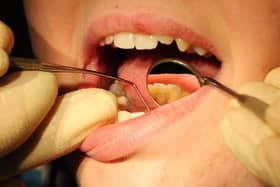 The impact of the coronavirus pandemic on dental care has been laid bare by new figures revealing a slump in treatments delivered to Peterborough patients. Photo: PA EMN-210309-135327001