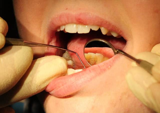 The impact of the coronavirus pandemic on dental care has been laid bare by new figures revealing a slump in treatments delivered to Peterborough patients. Photo: PA EMN-210309-135327001