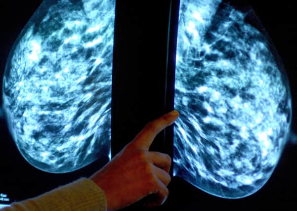 Thousands of women miss “vital” breast cancer screenings in Peterborough. Photo: PA EMN-210110-122116001
