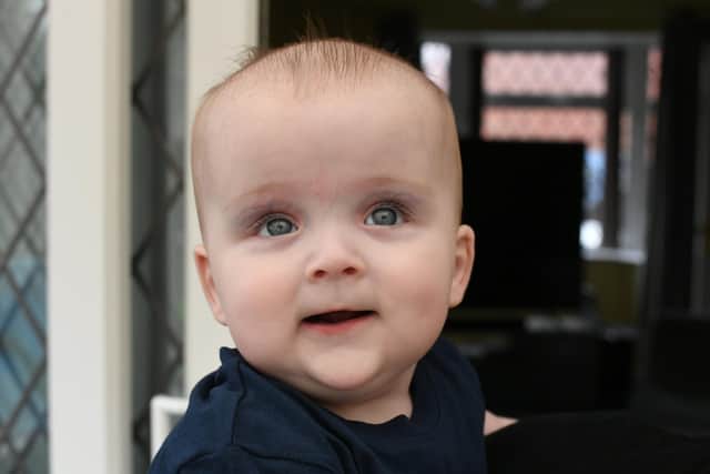 Amelia Coverdale is hoping a new US-based therapy developed to help children with spina bifida will improve baby Noah's chances of walking when he is older.