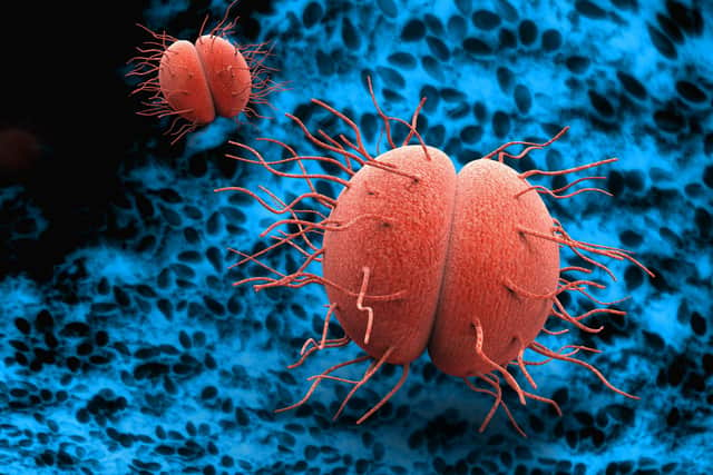 Gonorrhoea and syphilis at record levels in 2022, according to the UK Government (pictured: bacteria neisseria gonorrhoeae/Adobe).
