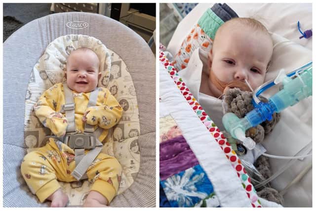 Four-month-old Esmae Wilkinson has been diagnosed with two holes in her heart. Doctors say she needs to be free of the Respiratory Syncytial Virus (RSV) she is currently battling before they can perform the open-heart surgery she needs.