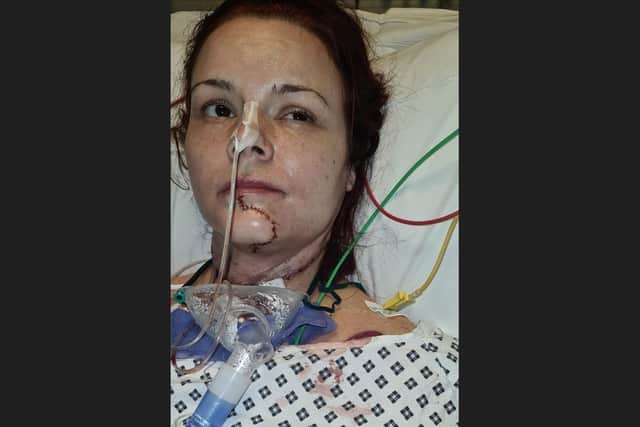 Gemma shortly after her operation.