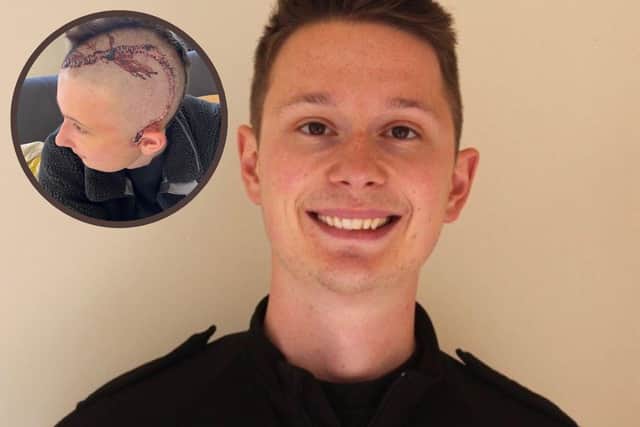 PC Leo Clarke suffered the injury after being attacked while on duty last year
