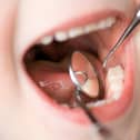 Figures painted a bleak picture of dental health for young children in Peterborough. overthehill - stock.adobe.com