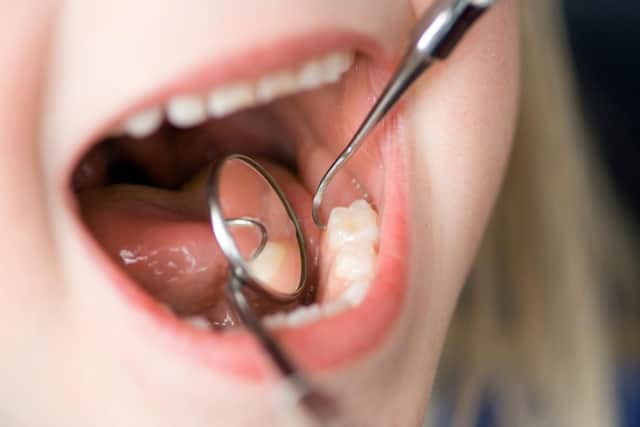 Figures painted a bleak picture of dental health for young children in Peterborough. overthehill - stock.adobe.com