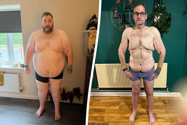 "I don’t like looking at myself in the mirror, and I feel like people judge me," says Wayne Shepherd, who has shed 21 stone since last year.  (image: SWNS)