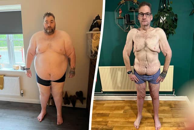 "I don’t like looking at myself in the mirror, and I feel like people judge me," says Wayne Shepherd, who has shed 21 stone since last year. (image: SWNS)