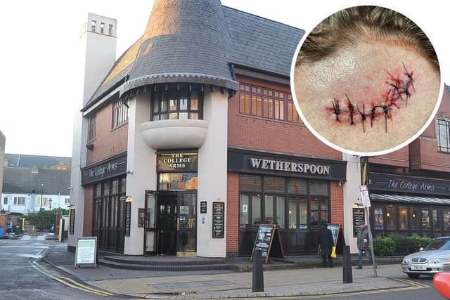 The victim needed a number of stitches after the incident at The College Arms