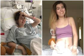 It took four years of symptoms before Sophie Anderson, now 24, was diagnosed with bowel cancer (image: Bowel Cancer UK)