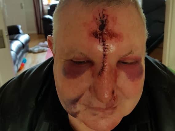 Philip Wetherilt suffered serious facial injuries in the attack