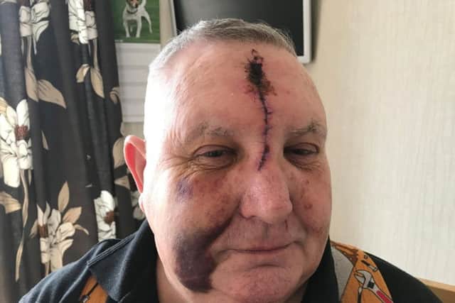 Philip Wetherilt suffered serious facial injuries in the attack