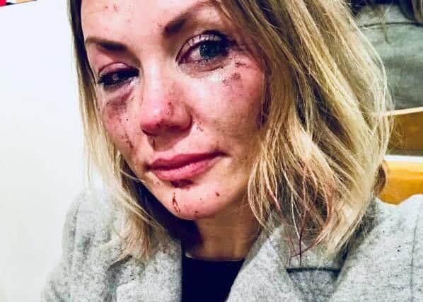 Natalie Moult, 37 who was attacked in Stamford