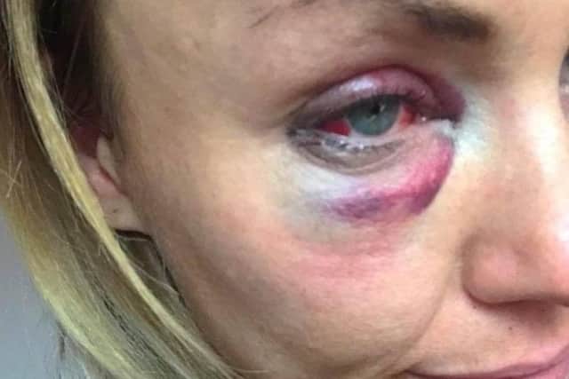 Natalie Moult, 37 who was attacked in Stamford