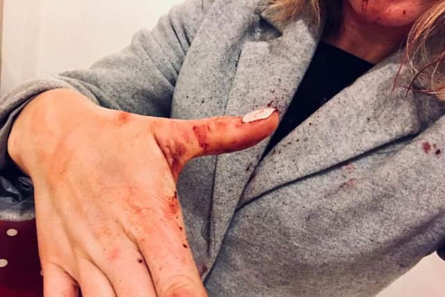 Natalie Moult, 37 who was attacked in Stamford