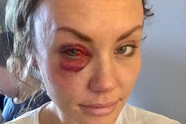 Natalie Moult, 37 who was attacked in Stamford