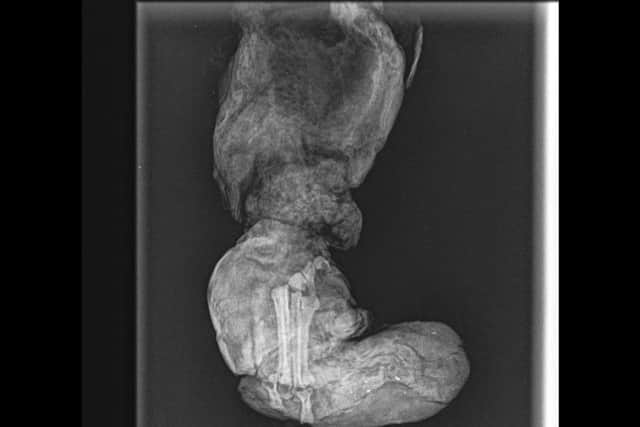 An x-ray of Benji's foot