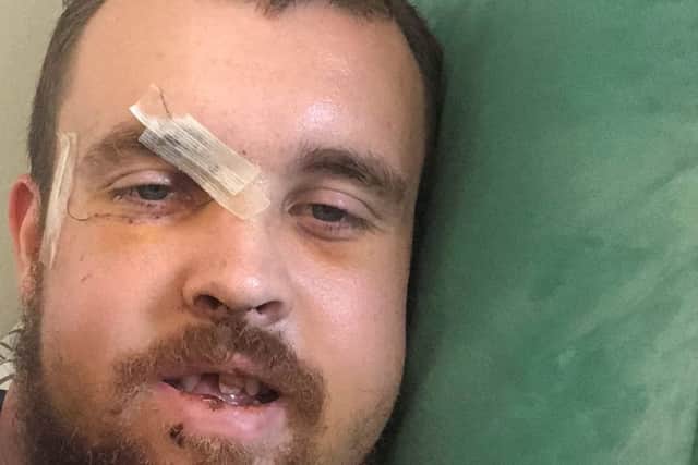 Calvin Dawson after he was attacked