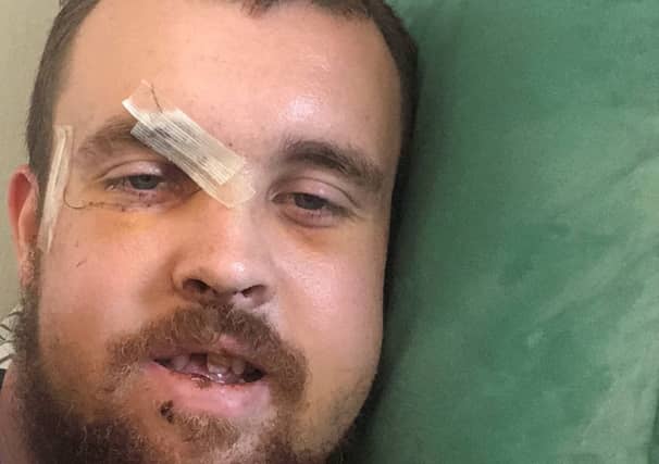 Calvin Dawson after he was attacked