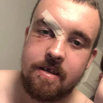 Calvin Dawson after he was attacked