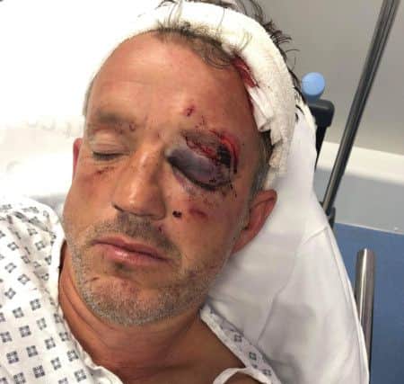 Gary in hospital