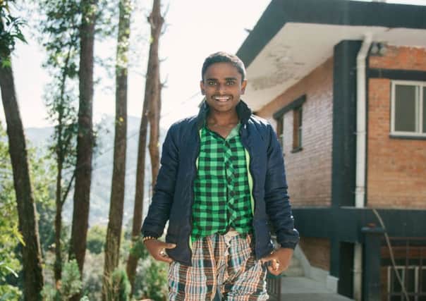 Santosh needed prosthetic legs after contracting the disease