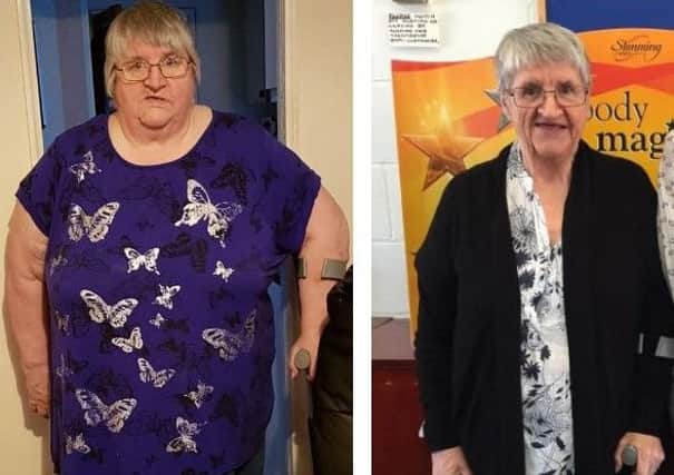 Shirley before and after her weight loss