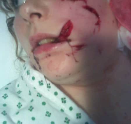 Georgia in hospital following the attack