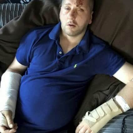 Matt Bullivant pictured recovering from his injuries after he fell through a balcony on his honeymoon. See SWNS story SWBALCONY; A new husband suffered a honeymoon from hell when he was seriously injured after he plummeted head first through a rotted balcony. Luckless newlywed Matt Bullivant, 36, had only just arrived at the bed and breakfast with his wife Marilyn, 51, when he went out to catch a glimpse of the picturesque surroundings. But the flimsy balustrade cracked under his weight and he fell 15ft - shattering his right hand and spitting open his head. The rest of his week-long honeymoon was spent in hospital.