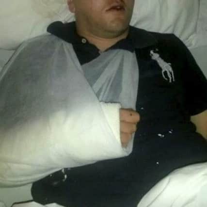 Matt Bullivant pictured recovering from his injuries after he fell through a balcony on his honeymoon. See SWNS story SWBALCONY; A new husband suffered a honeymoon from hell when he was seriously injured after he plummeted head first through a rotted balcony. Luckless newlywed Matt Bullivant, 36, had only just arrived at the bed and breakfast with his wife Marilyn, 51, when he went out to catch a glimpse of the picturesque surroundings. But the flimsy balustrade cracked under his weight and he fell 15ft - shattering his right hand and spitting open his head. The rest of his week-long honeymoon was spent in hospital.