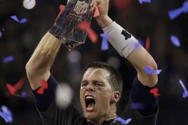 Tom Brady, my hero of the wporting week.