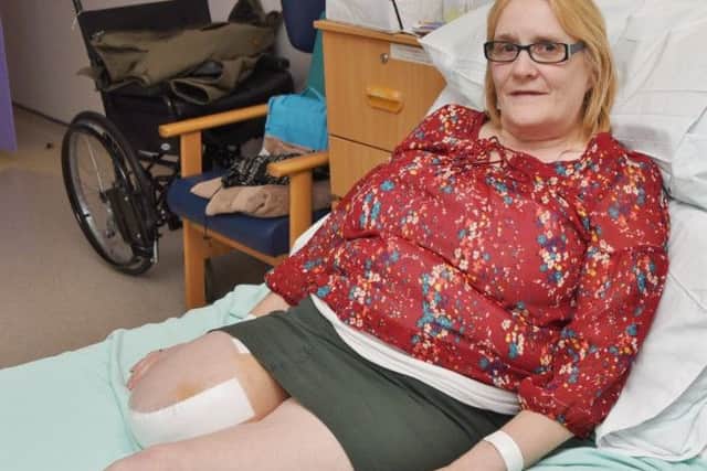 Tunisian beach terror attack victim Shirley Church, who has since lost a leg,  following surgery from injuries sustained in the attack. She is now recovering from surgery at Peterborough City Hospital EMN-170413-194724009