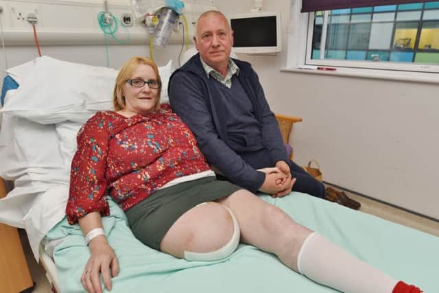 Tunisian beach terror attack victim Shirley Church, who has since lost a leg,  following surgery from injuries sustained in the attack. She is now recovering from surgery at Peterborough City Hospital. She is with her husband  Joe Church EMN-170413-194526009