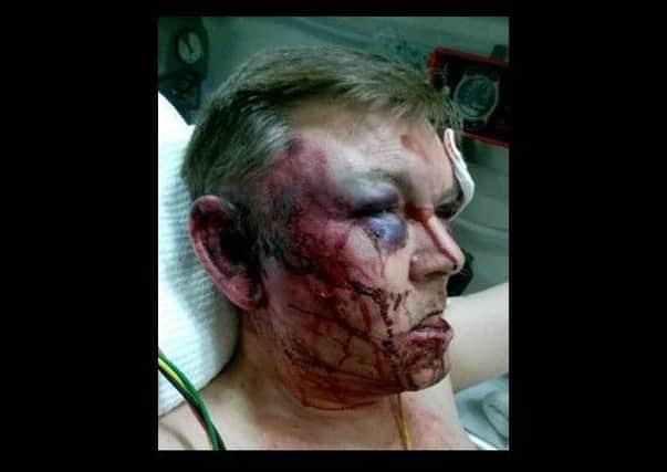 Police have released this photo of the victim in hospital with his permission